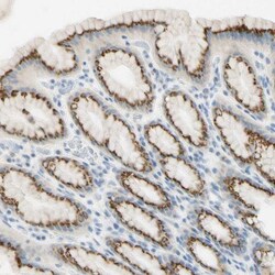 GALNT5 Antibody, Novus Biologicals 0.1mL; Unlabeled:Antibodies, Polyclonal
